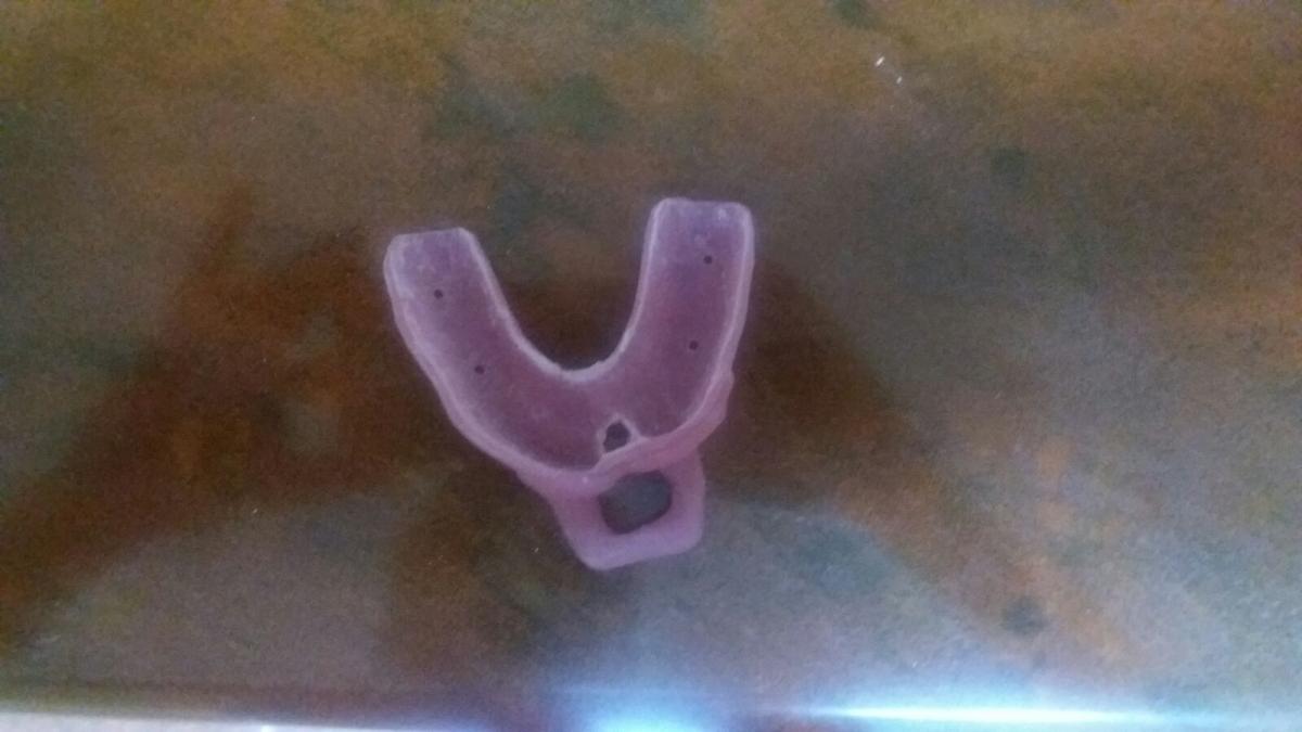 Protetică - Lingură individuală pentru amprentare